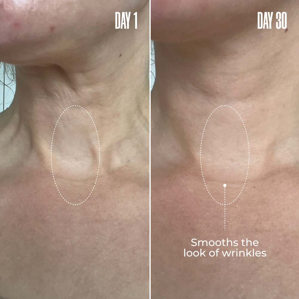 B-POISED Neck & Décolleté Firming Cream