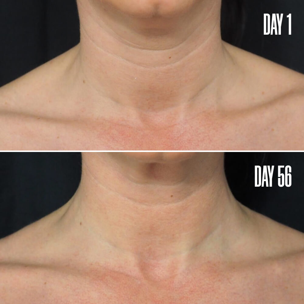 BPOISED Neck & Décolleté Lifting & Firming Cream MAЁLYS®