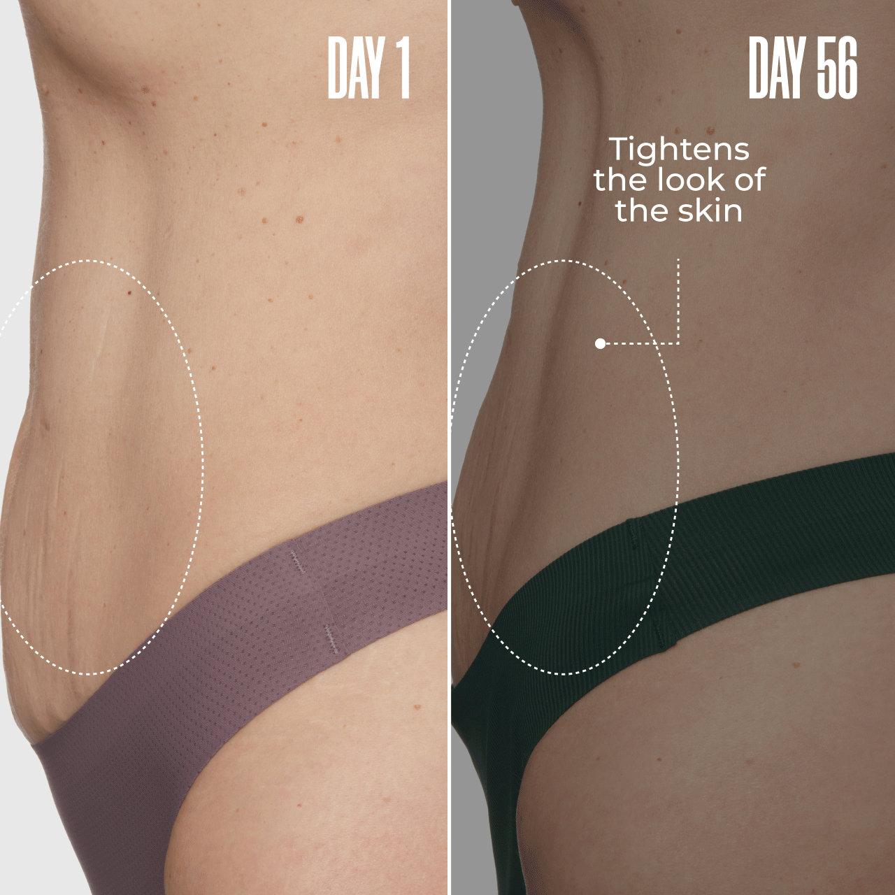 1. GET-DREAMY Actually Tightens The Look Of Your FUPA