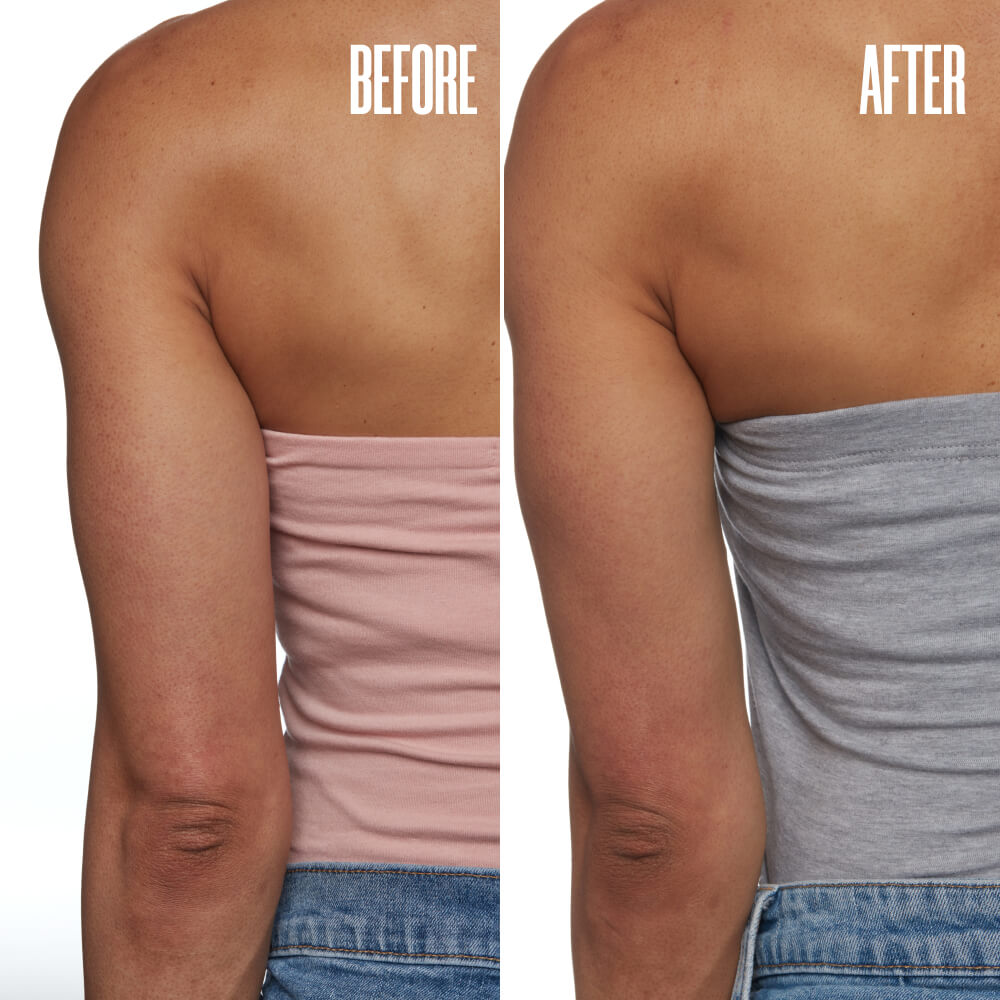 GETLEVEL Keratosis Pilaris Body Scrub MAЁLYS®