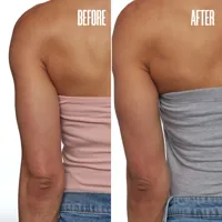 GET-LEVEL Keratosis Pilaris Body Scrub