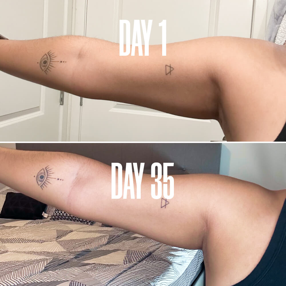 BFLEX Arm Skin Firming and Tightening Cream MAЁLYS®