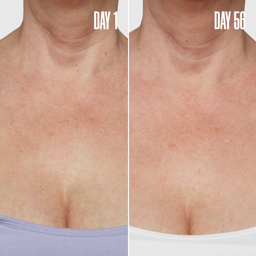 GLOSS ‘N’ POISE The Anti-Aging Duo | MAЁLYS®