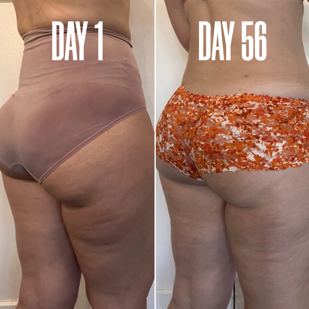 The Cellulite Duo package