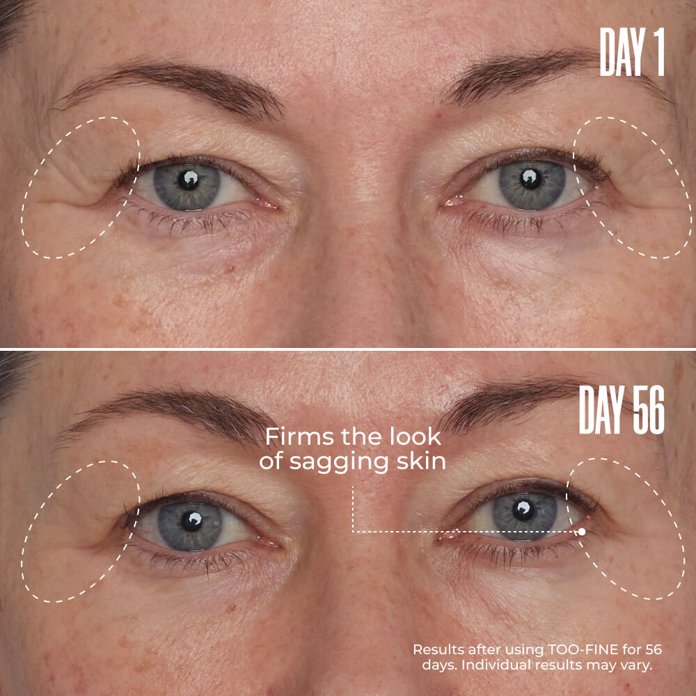TOO-FINE Clinically Proven Face Sculpting Serum