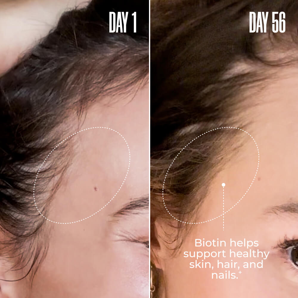 COLLAGEN + BIOTIN Super Charged Liquid Collagen | MAЁLYS®