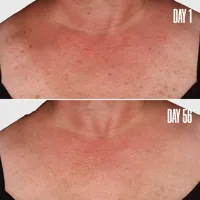 B-GLOWY Brightening Body Serum