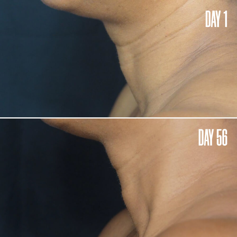 GLOSS ‘N’ POISE The Anti-Aging Duo | MAЁLYS®