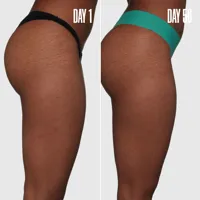 B-SLEEK Outer Thigh Stretch Mark Cream