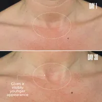B-POISED Neck & Décolleté Firming Cream