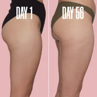 HOME STRETCH The Stretch Mark Bundle
