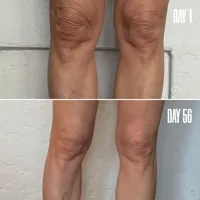BLUR ‘N’ SMOOTH The Wrinkle & Vein Duo 