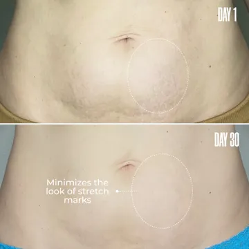 RE-LURE Tight & Tone Body Serum | MAЁLYS®