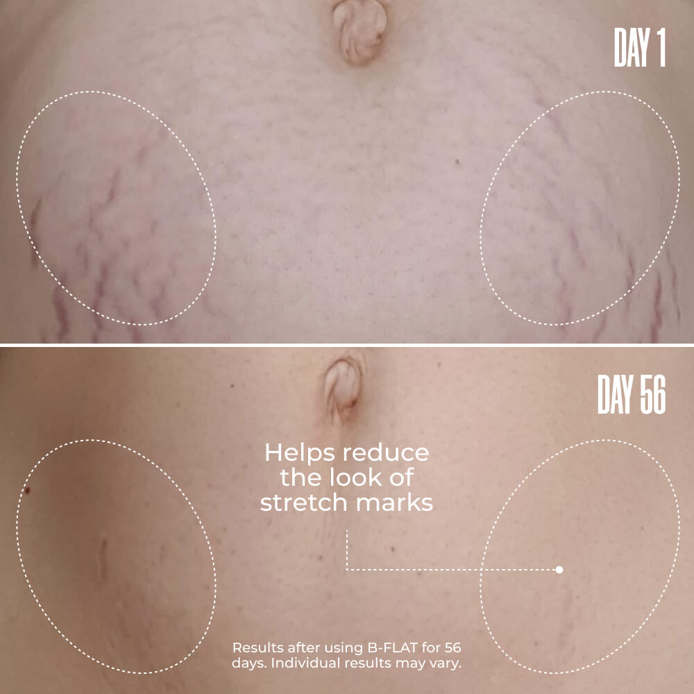 B-FLAT Belly Firming Cream
