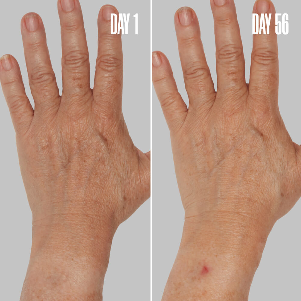 GLOSS ‘N’ POISE The Anti-Aging Duo | MAЁLYS®