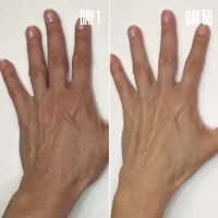 BLUR ‘N’ SMOOTH The Wrinkle & Vein Duo 