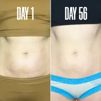 DREAM BOD The Body Sculpting Duo 