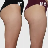 B-SLEEK Outer Thigh Stretch Mark Cream