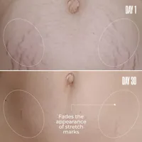 GET FLATTERED The Loose Skin Duo | MAЁLYS®