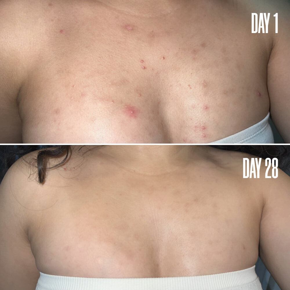 RE-SET Balancing Body Serum