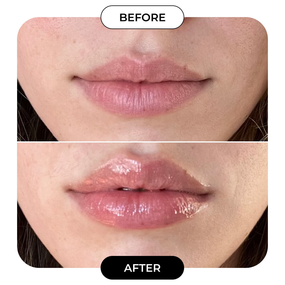 SMOOCHIT Lip Plumping Kit with Scrub & Lip Puff MAЁLYS®