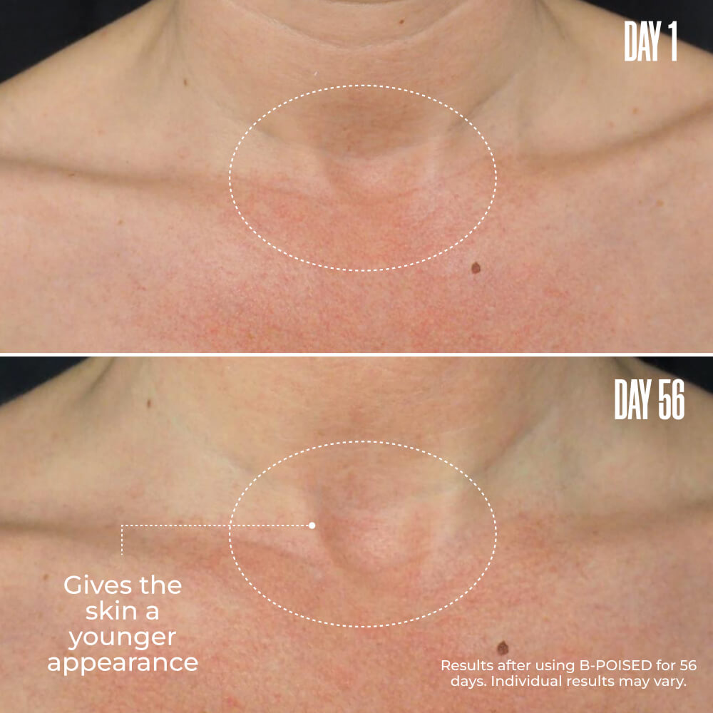 B-POISED Neck & Décolleté Firming Cream