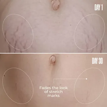 B-FLAT Belly Firming Cream