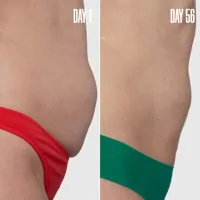 DREAM BOD The Body Sculpting Duo 