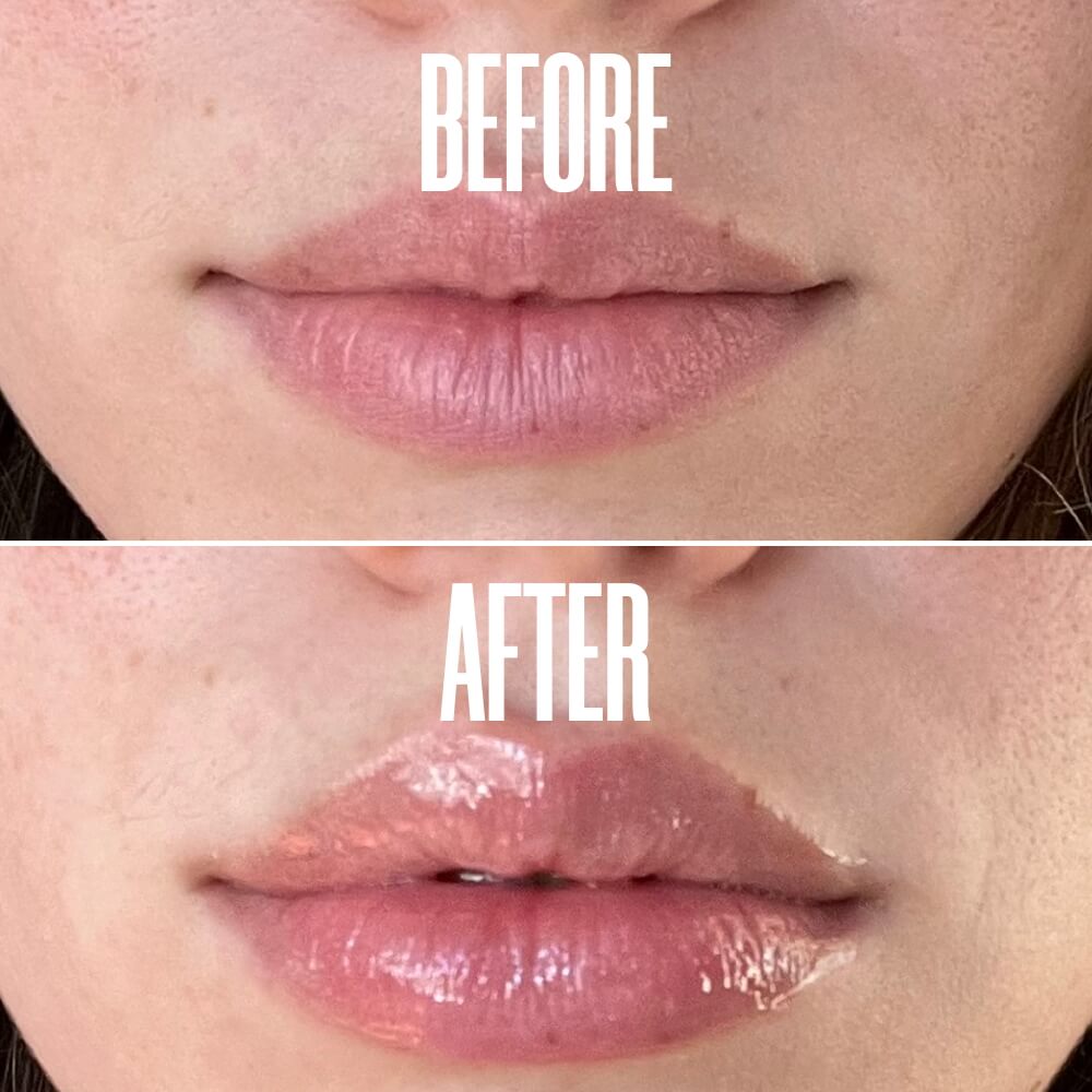 SMOOCHIT Lip Plumping Kit with Scrub & Lip Puff MAЁLYS®