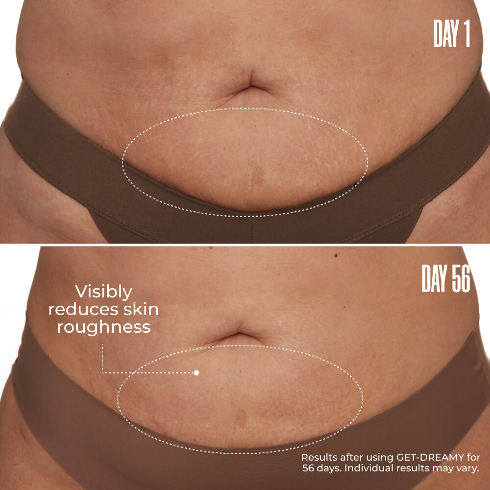 GET-DREAMY Overnight Toning Whip