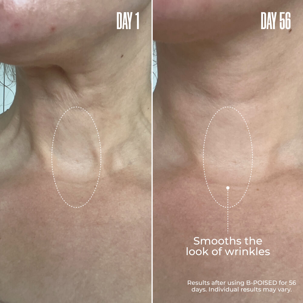 B-POISED Neck & Décolleté Firming Cream