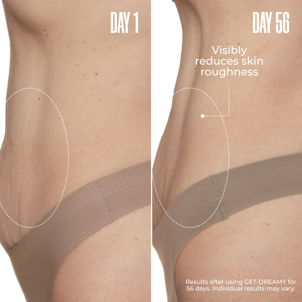 GET-DREAMY Overnight Toning Whip